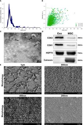 Immunomodulatory effect of PLGA-encapsulated mesenchymal stem cells-derived exosomes for the treatment of allergic rhinitis